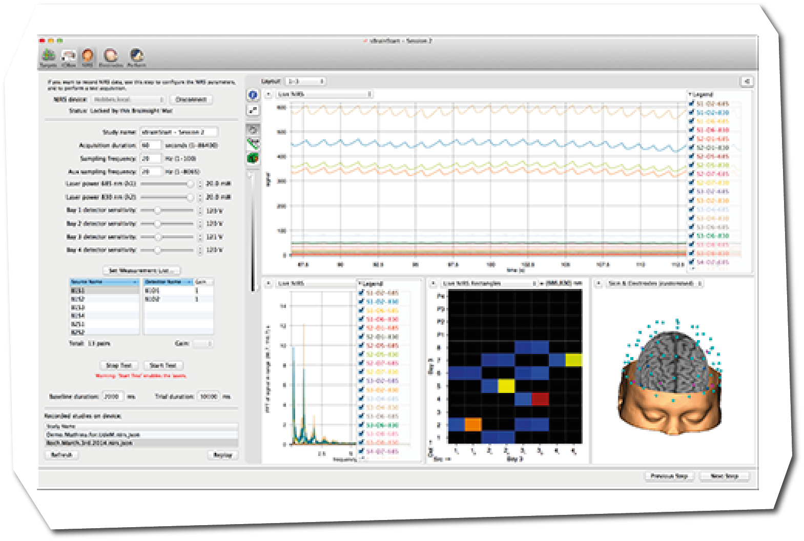 Brainsight NIRS System Brainbox